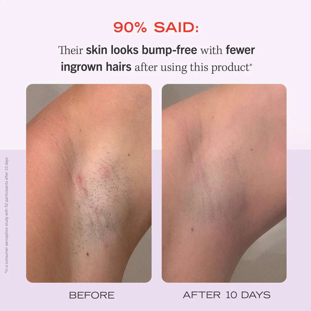 FIRST AID BEAUTY / INGROW HAIR PADS