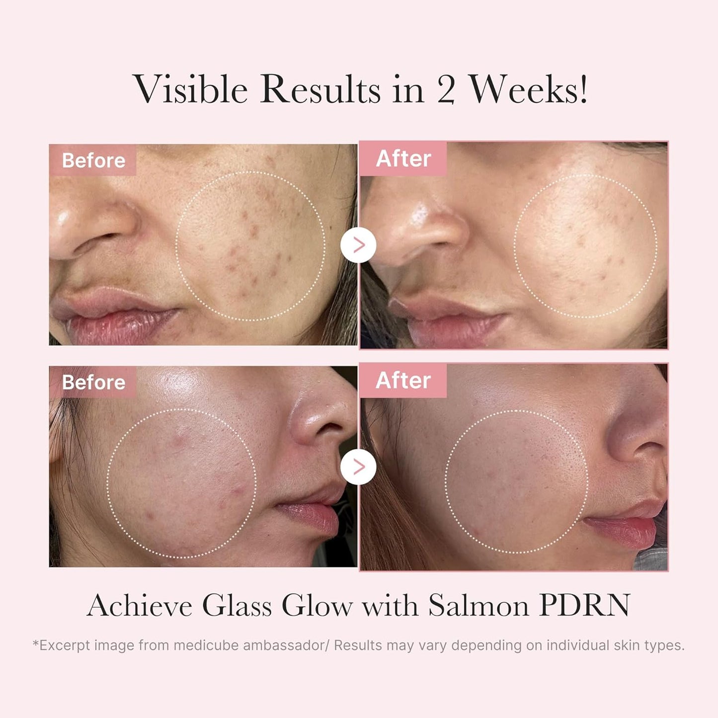 MEDICUBE / PDRN GLOW KIT
